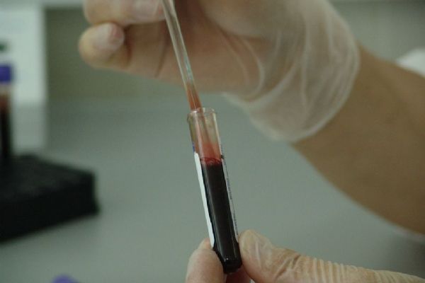Pět nových pacientů nakažených virem HIV přibylo letos v kraji
