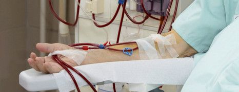 Plzeňské dialyzační středisko je na pacienty s covidem připraveno